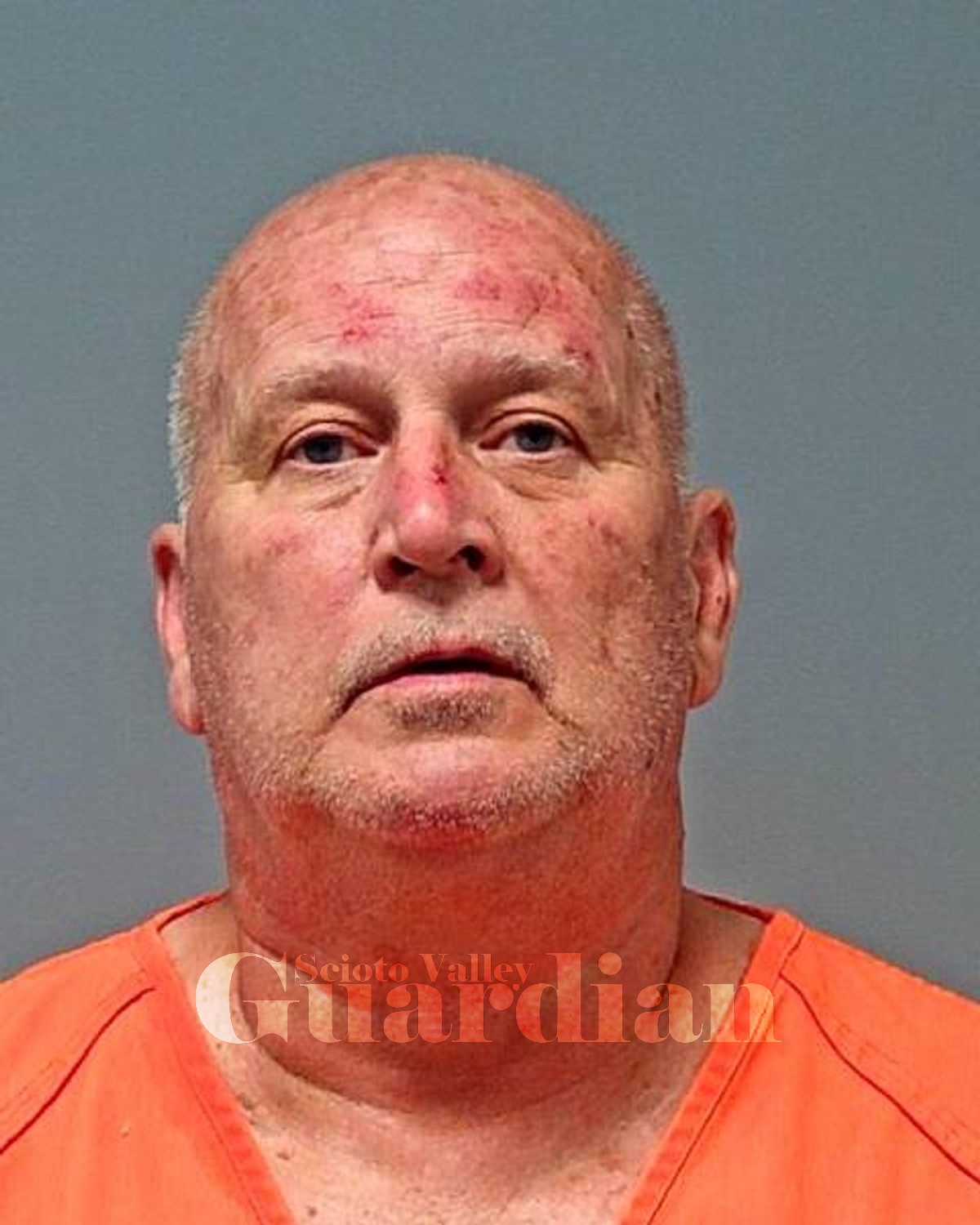 Burnett, Jonathan J